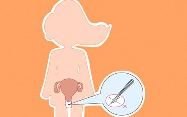 37岁始基子宫怀孕困难，做试管婴儿能腹部取卵吗？