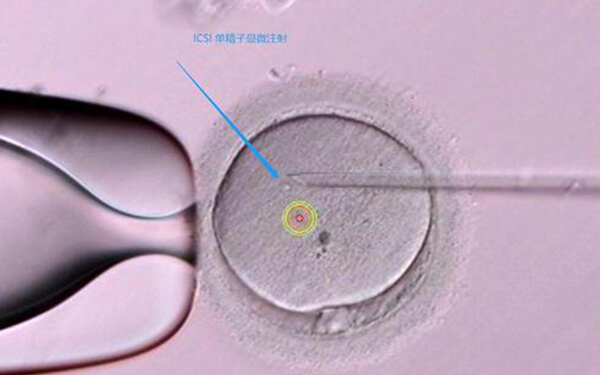 3ab囊胚究竟怎么样？移植成功率、质量双重评估