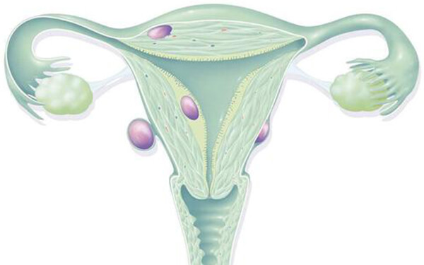 双侧输卵管堵塞怀孕难，试管婴儿or手术疏通如何选择好？