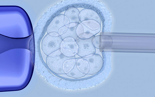 鲜胚移植第3天就着床了？移植三天胚胎的状态介绍