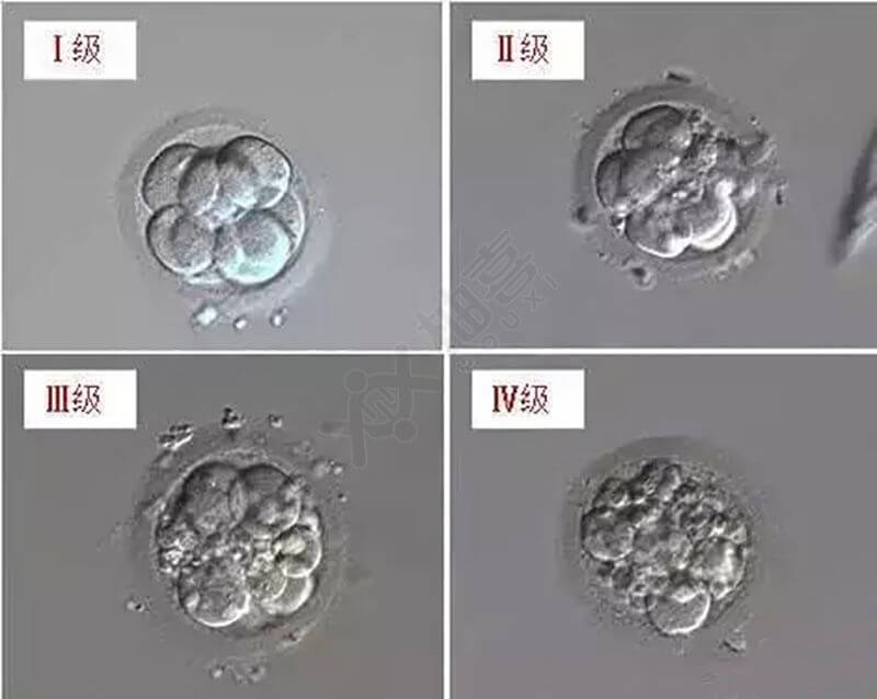 D3胚胎等级怎么分