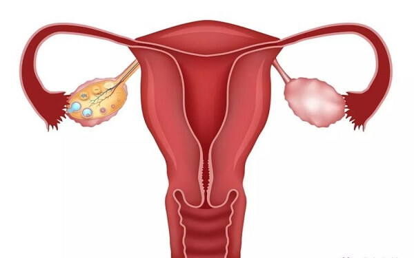 宫腔环境不好的症状有哪些？