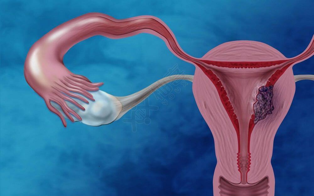 宫腔环境该如何检查