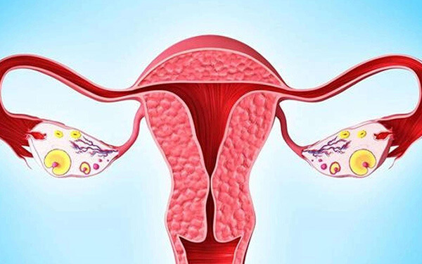 多囊卵巢综合症的5大真相，解除你的误解！