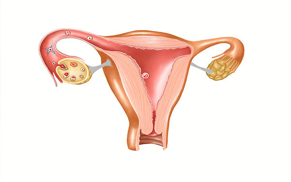 单角子宫怀孕25周后宫缩是什么意思，它是怎么造成的？