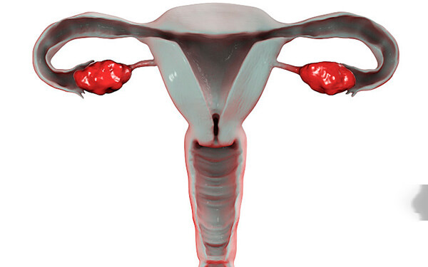 先天性子宫畸形,除自然生育率30%外,还有哪些影响?