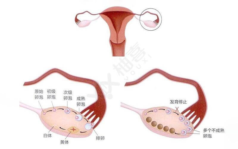 多囊促排怀孕成功率有多高