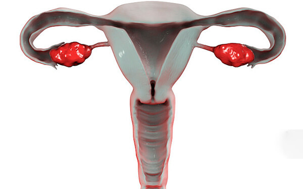 输卵管堵塞做切除后有什么危害？