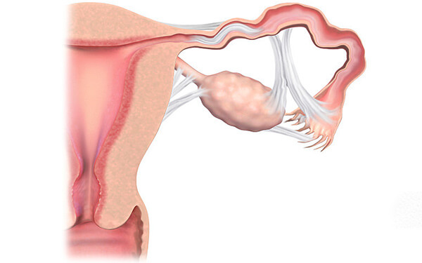 切除两边输卵管会对女性以后的生育能力产生影响吗？