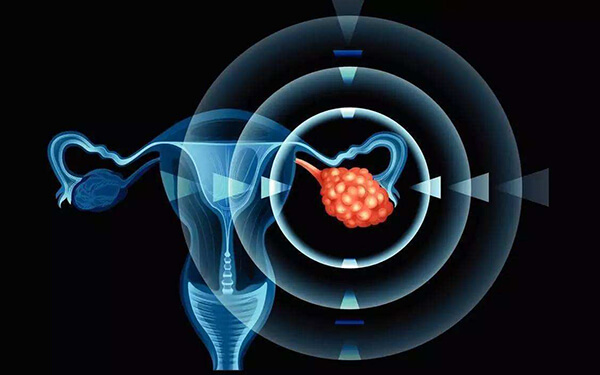 卵巢破裂的危害是什么？会影响生育吗？
