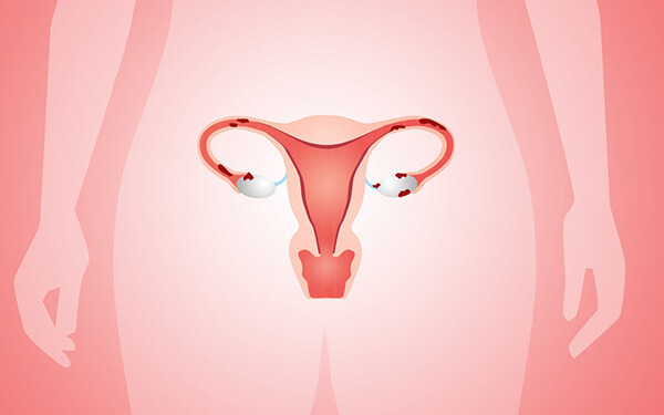 先天无子宫且卵巢正常,好孕难关有2点,腹部取卵能帮其一