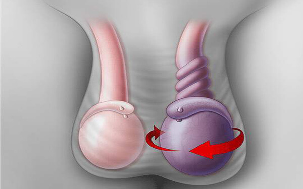 先天性睾丸异常有哪些症状，生殖器无力算吗？