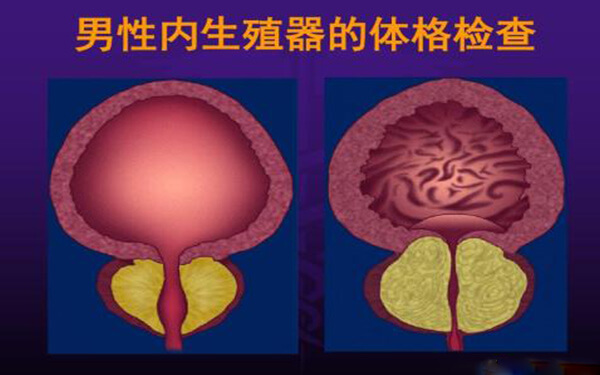 医院确诊为睾丸发育不良，它到底是什么原因引起的？