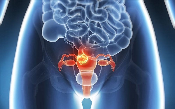 最常见的输卵管疾病有哪些？都会导致不孕吗？