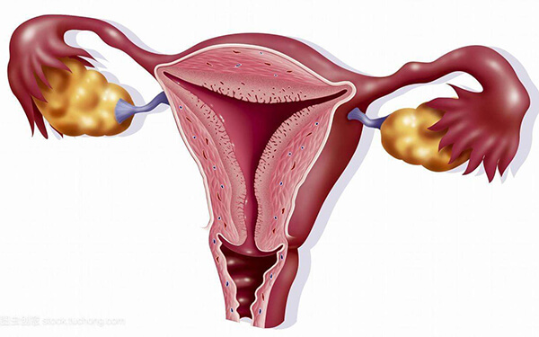 子宫腺肌症可以怀孕吗？是否一定要治疗后备孕？