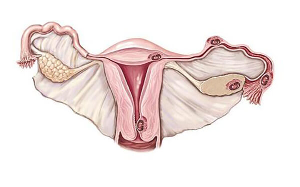 据说子宫腺肌症会影响怀孕，这到底是什么病？