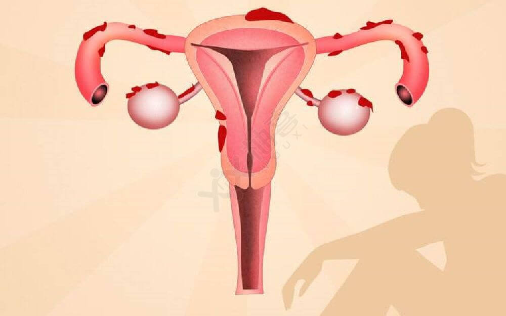 输卵管堵塞有什么症状
