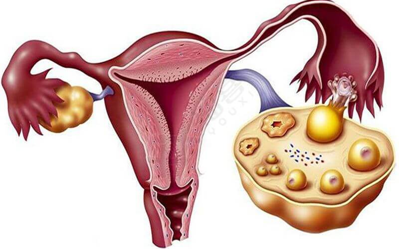 卵巢早衰能做试管婴儿