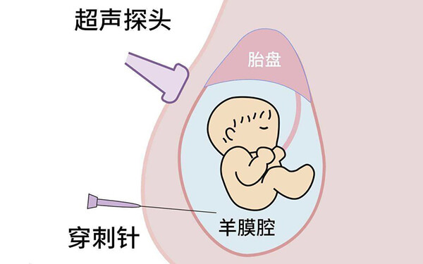 孕前检查血型rh阳性是什么意思?