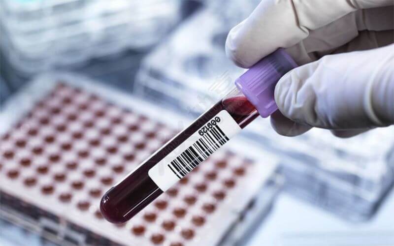 孟买血型人群生育检查