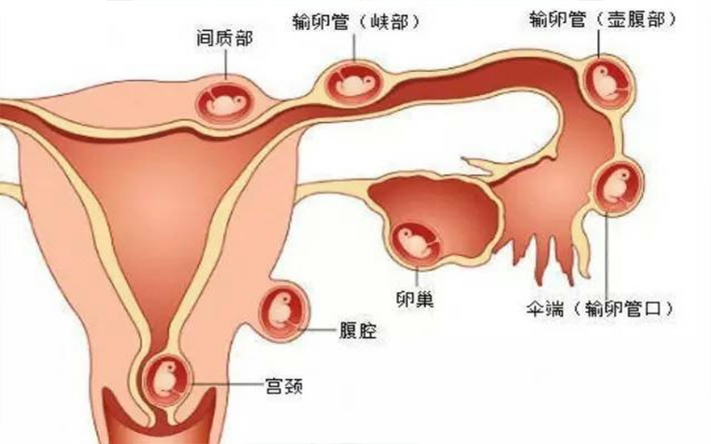 子宫结构图示