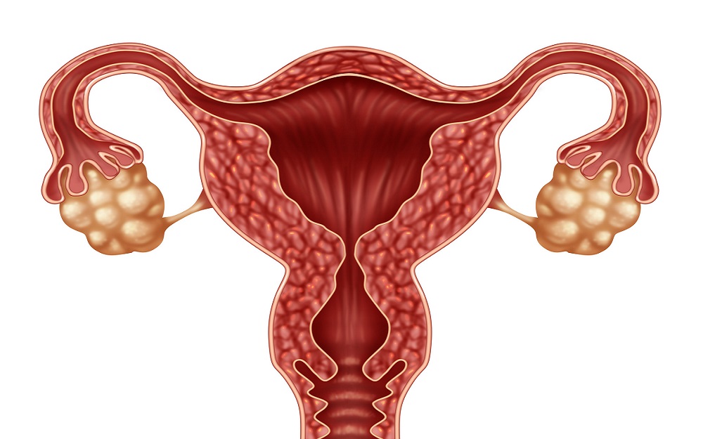 输卵管堵塞可做试管怀孕