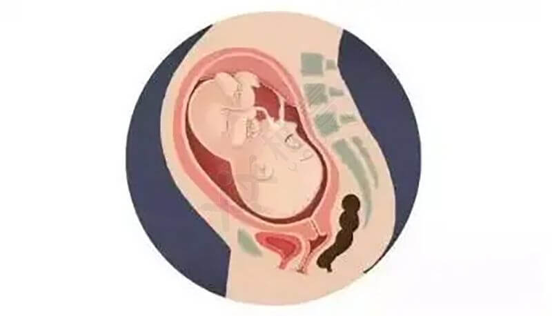 胎儿头位
