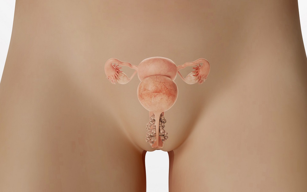 输卵管息肉会导致不孕