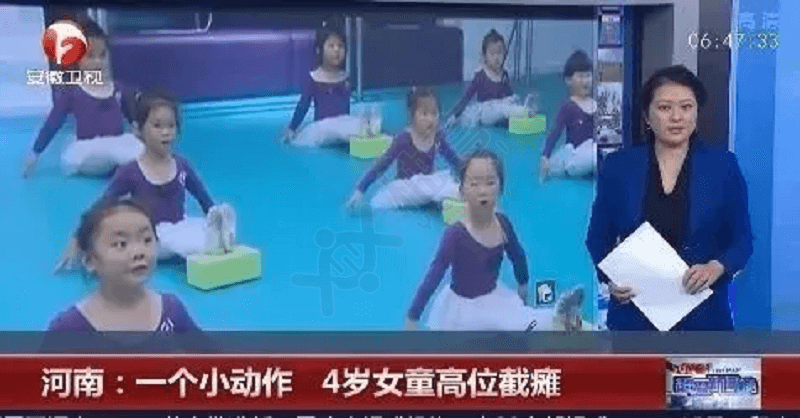 4岁女童学舞蹈高位截瘫