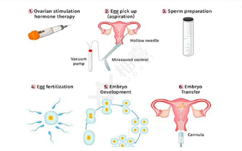 进行胚胎移植的过程