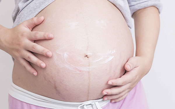 妊娠纹什么时候开始长？科普怀孕6个月出现的那些征兆