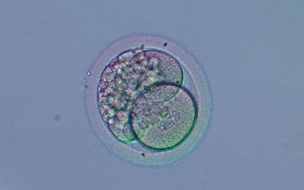 取卵后胚胎有4个等级，ABCD您的属于哪个级别？