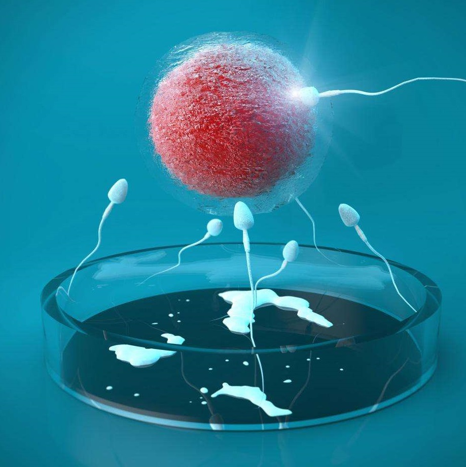 NGC国际生殖中心试管助孕方式
