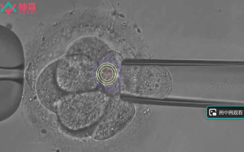 通过小针管提取优质胚胎