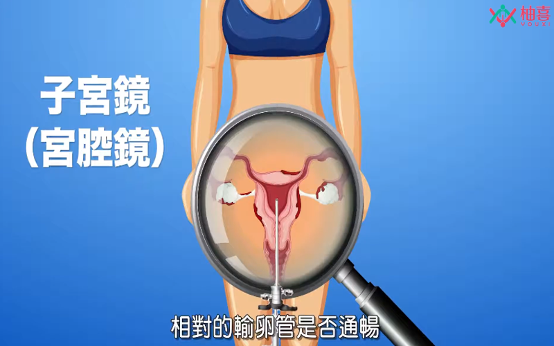 宫腔镜可以检查输卵管是否通畅