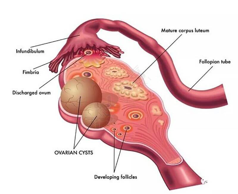 卵巢结构图