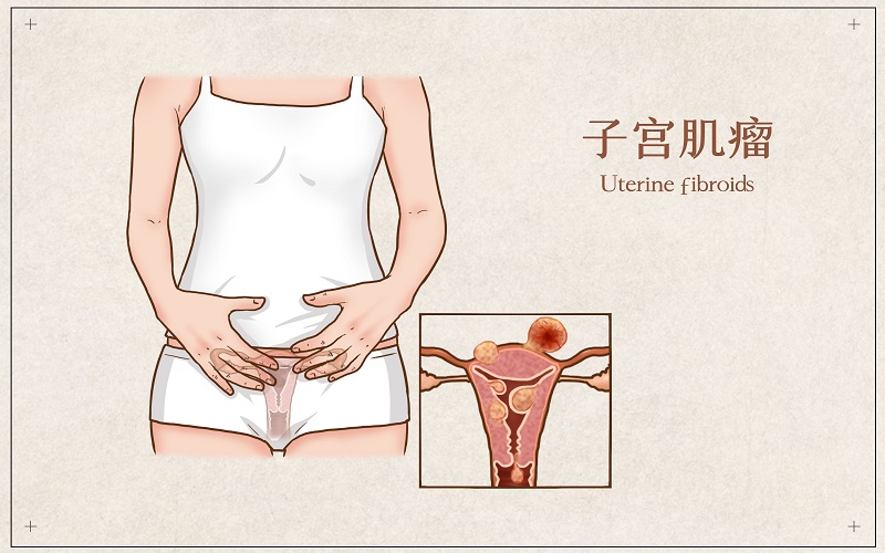 宫腔环境不好怀孕