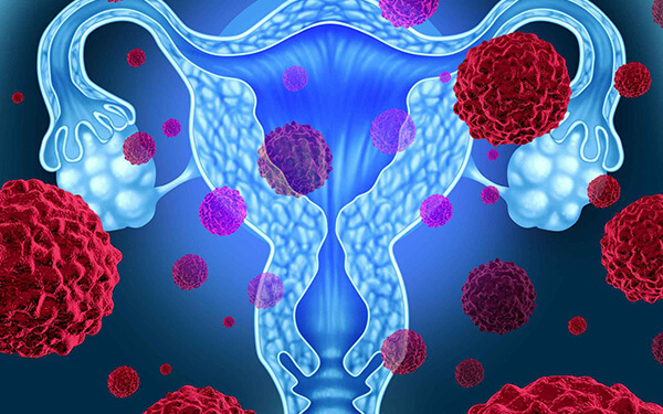科学才能备好孕!子宫肌瘤的不同情况决定是否先治疗再试管
