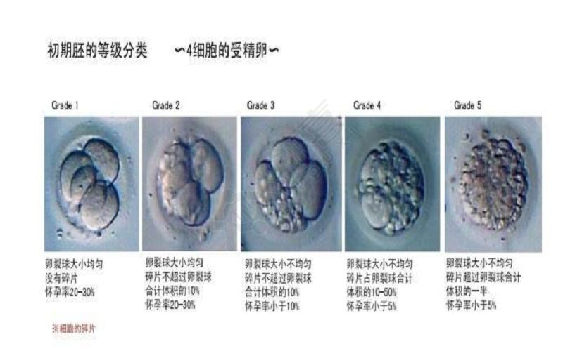 胚胎等级分类图