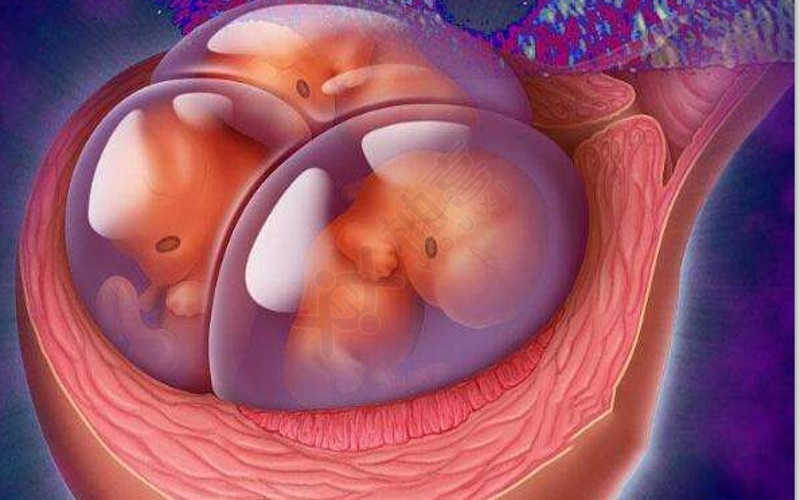 移植多个胚胎容易造成多胎妊娠