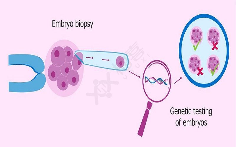 试管婴儿会筛除有遗传疾病的胚胎