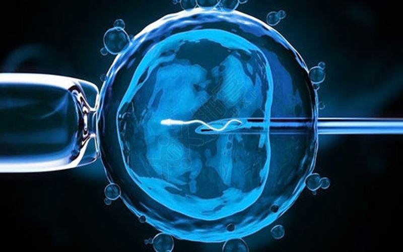 卵母细胞胞浆内单精子显微注射