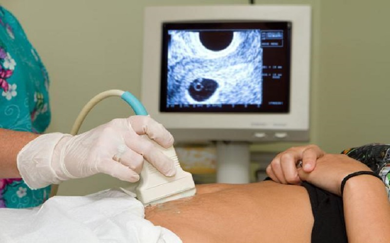 宫外孕需要b超检查