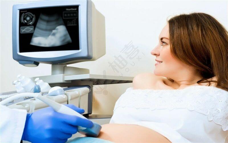 B超观察腹中胎儿情况
