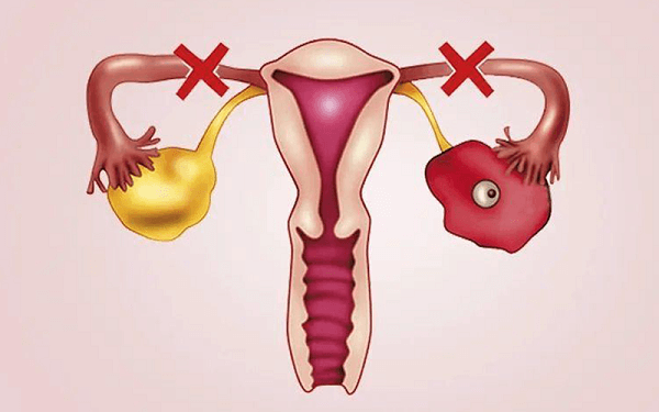 生化妊娠的危害不容小觑！小心别堵了你的输卵管