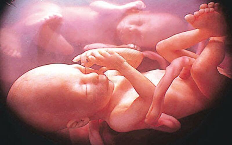 多胎妊娠胎儿子宫发育情况