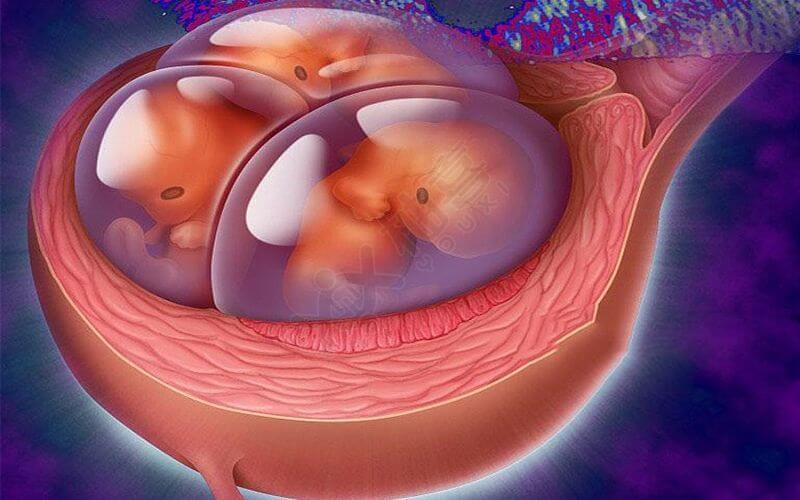 多胎妊娠子宫内胎儿情况