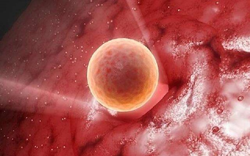 阴道出血是鲜胚着床后症状之一