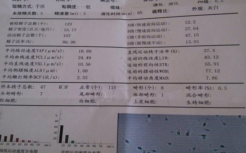 精液常规检查报告单图片