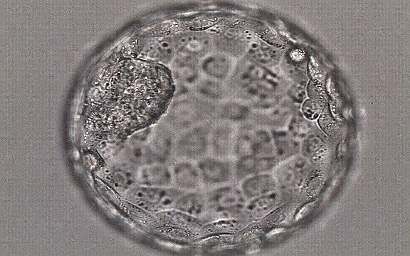4bc是囊胚质量的一种评级